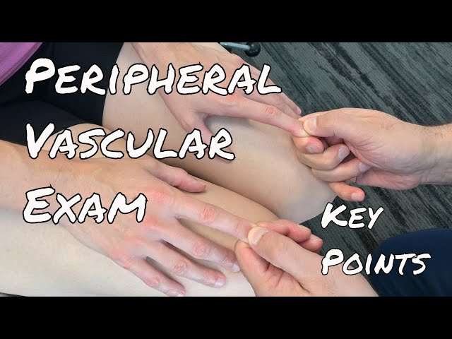 Peripheral Vascular Examination - Key Points