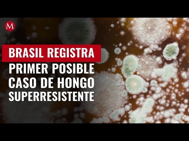 Brasil registra posible caso de infección por hongo resistente y potencialmente mortal