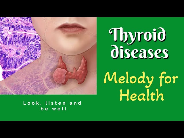 Thyroid. Treatment. Music Therapy. Recommendations.