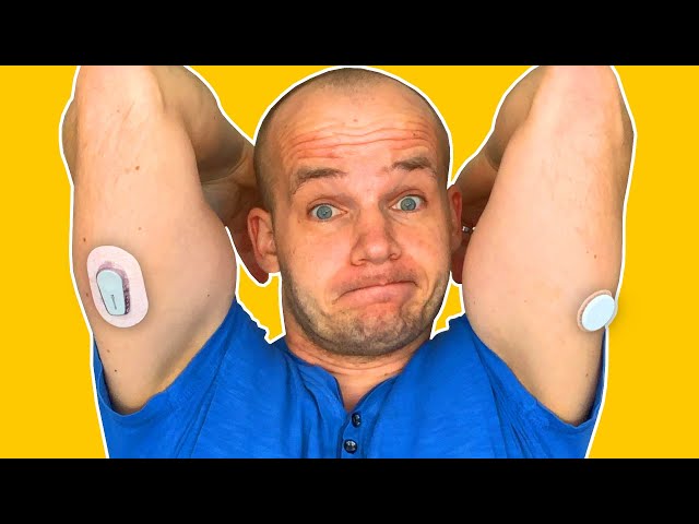 FreeStyle Libre 2 vs Dexcom G6 | Full Review & My Experience