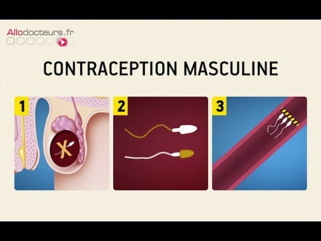 Contraception masculine : rêve ou réalité ? - Le Magazine de la santé
