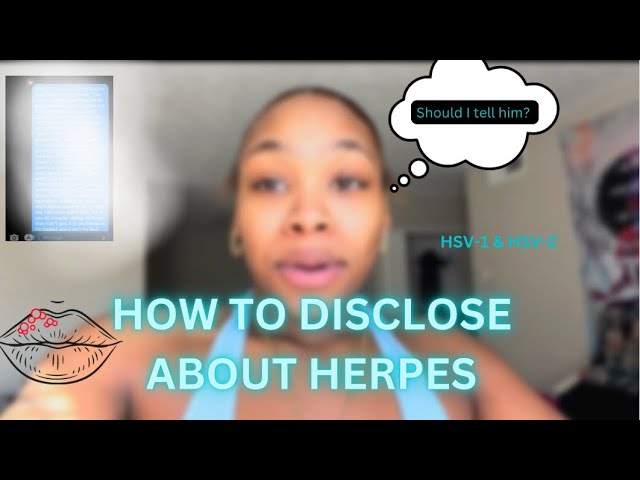 HOW TO TELL SOMEONE YOU HAVE HERPES