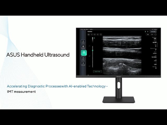 ASUS Handheld Ultrasound LU800 | Introduction to IMT measurement