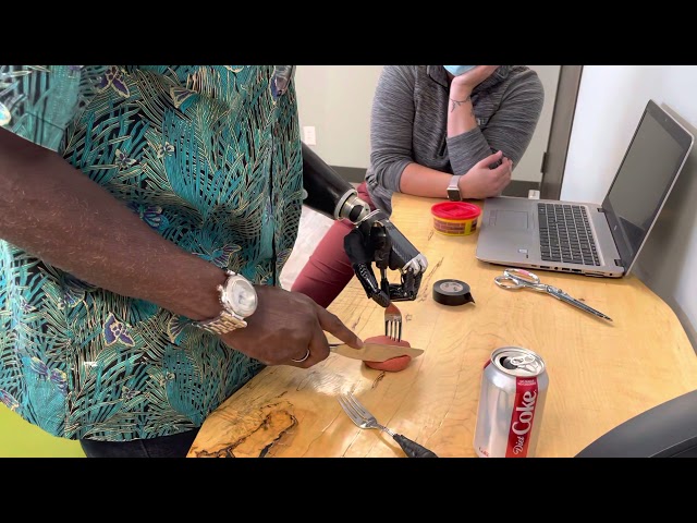 GMO Cutting the Steak 🥩 with his new hand !! BeBionic!!