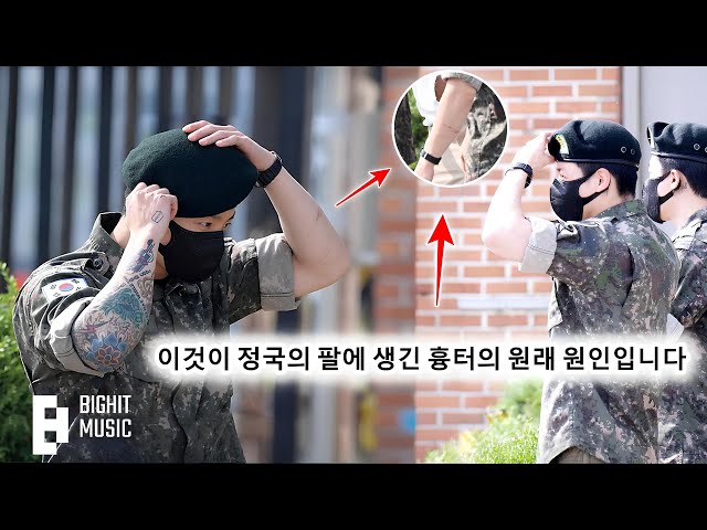 Shocking Facts! Jungkook Explains The Original Cause Of The Scar On His Arm