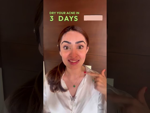 Dry Acne in 3 days I 3-step skincare routine acne and breakouts I FaceYogaByVibhutiArora #acne