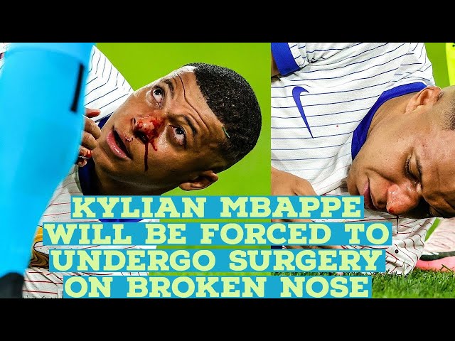 Mbappe is set to undergo a nose surgery