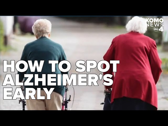 The early signs of Alzheimer's to look out for, explained