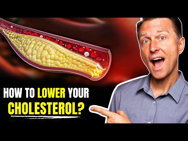 Lower Your Cholesterol Naturally with These Powerful Foods! | Dr. Eric Berg