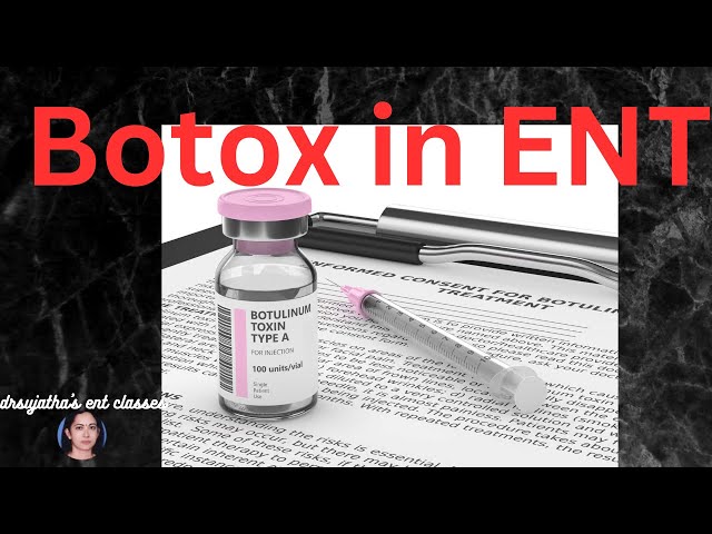 230.Botox in Otolaryngology #botoxbeforeandafter