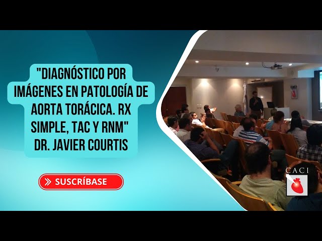 Jornada de Docencia "Diagnóstico por imágenes en patología de Aorta Torácica. Rx Simple, TAC y RNM"