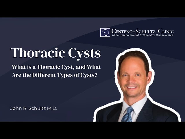 Thoracic Cysts: What is a Thoracic Cyst, and What Are the Different Types of Cysts? - w/ Dr. Schultz