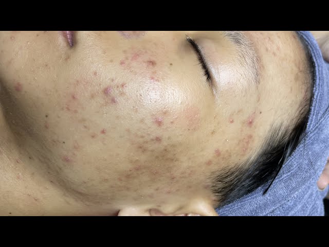 Satisfying video with Chung Vo Spa #123