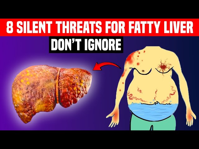 A Silent Threat: 8 Alarms that could Indicate Fatty Liver Disease