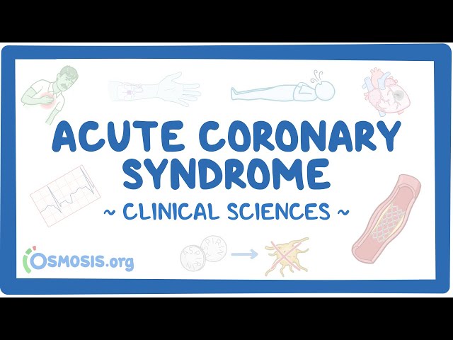 Acute coronary syndrome: Clinical sciences