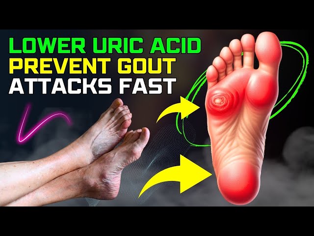 ✅ Top 10 Foods to Lower Uric Acid and Prevent Gout Attacks FAST!