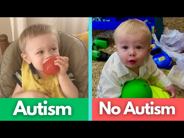 12 signs of Autism in a 1-year-old