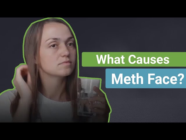 What Causes Meth Face?