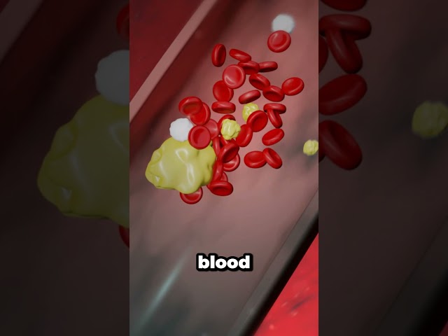 How a blood clot actually causes a heart attack? #Medical #animation #heartattack