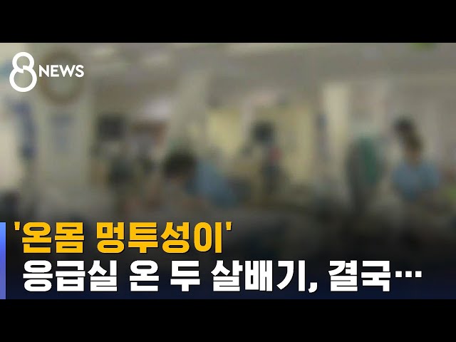 응급실 실려온 16개월 아기 사망…온몸에 멍투성이 / SBS