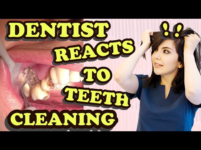 Dentist Reacts to Teeth Cleaning Videos