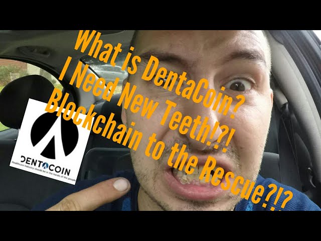 What is DentaCoin?