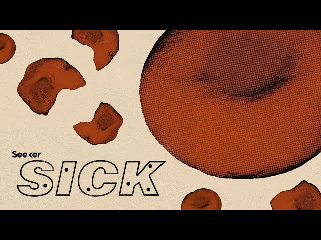 What Causes Sickle Cell...and How Are We Treating It?