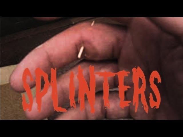 "Splinters"