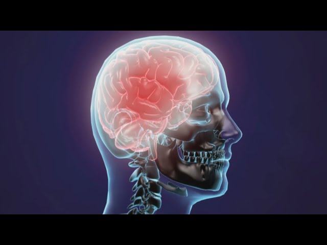 Free webinar to improve brain health and protect against dementia