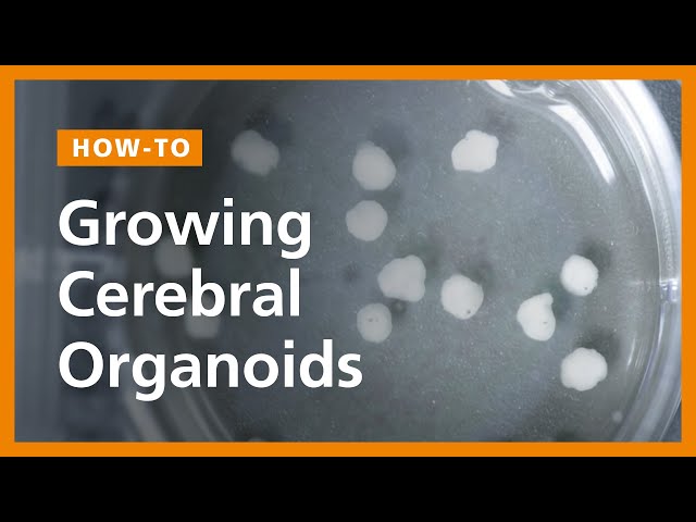 How to Grow Cerebral Organoids from Human Pluripotent Stem Cells