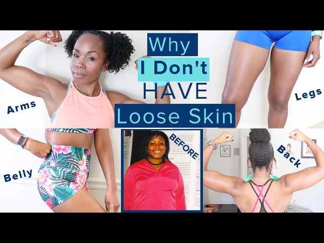 Why I Don't Have LOOSE SKIN After 100 Pound Weight Loss WITHOUT Surgery | TMI Skincare & Nutrition
