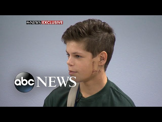 13-year-old shark attack survivor returns to school