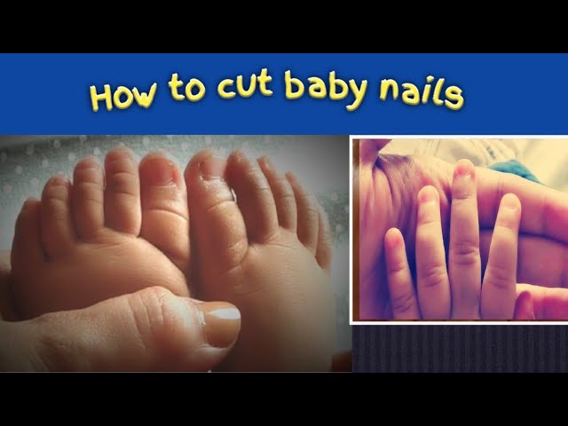 छोटे बच्चे के नाख़ून काटने से डर लगता हैं ? तो एक बार ये वीडियो जरूर देखे l How to Cut Baby's Nails |