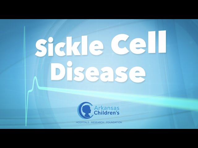 Ask the Experts - Sickle Cell Disease - Types, Diagnosis, and Treatments