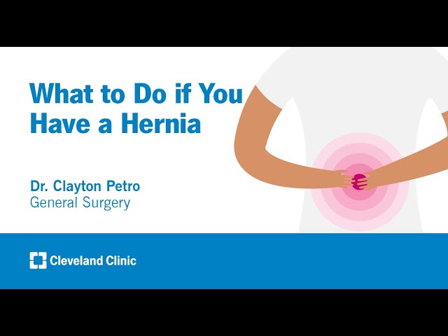 What to Do if You Have a Hernia | Clayton Petro, MD