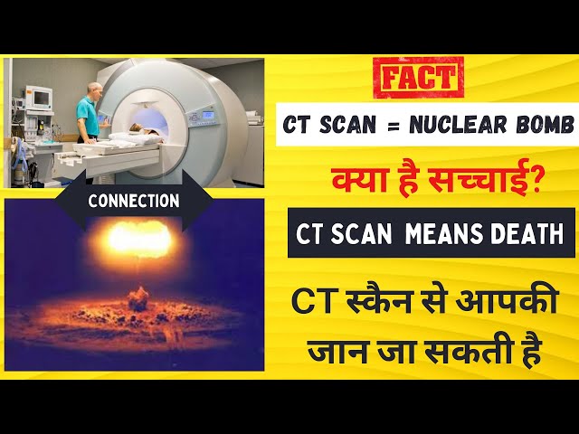 CT स्कैन से आपकी जान जा सकती है | CT SCAN = NUCLEAR BOMB #shorts