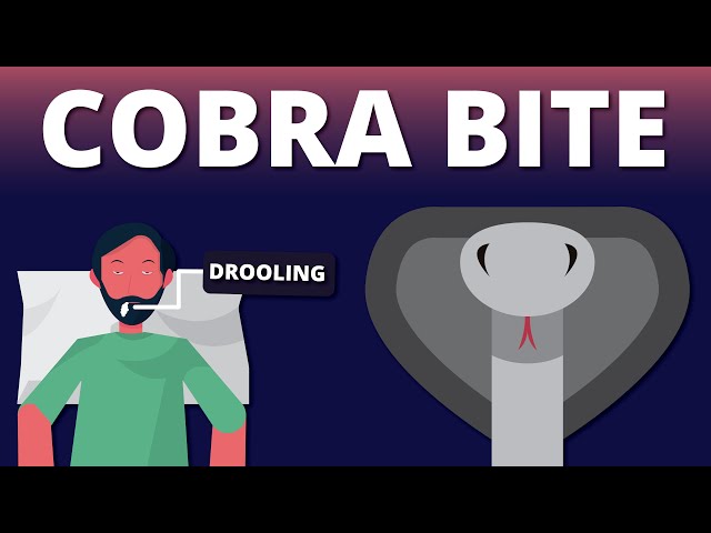 A case of Cobra Bite Emergency (Snake Venom Animation)