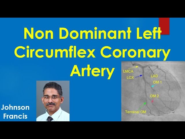 Non Dominant Left Circumflex Coronary Artery