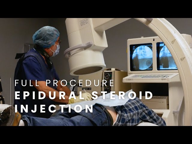 Epidural Steroid Injection For Chronic Pain Full Procedure