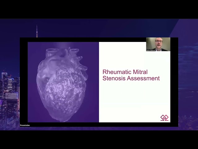 SUN 9 45 Carlos Galhardo – Rheumatic Mitral Valve Disease  What are the take home points from the ne