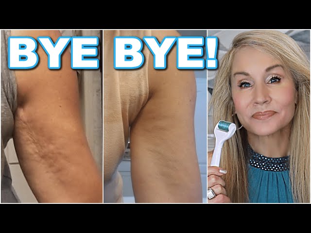 HOW TO REDUCE BATWINGS & CREPEY SKIN NATURALLY | GO SLEEVELESS AT SIXTY! | FOUR MONTH RESULTS