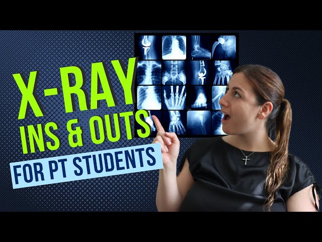 X-Ray explained! What you need to know as a Physical Therapy Student