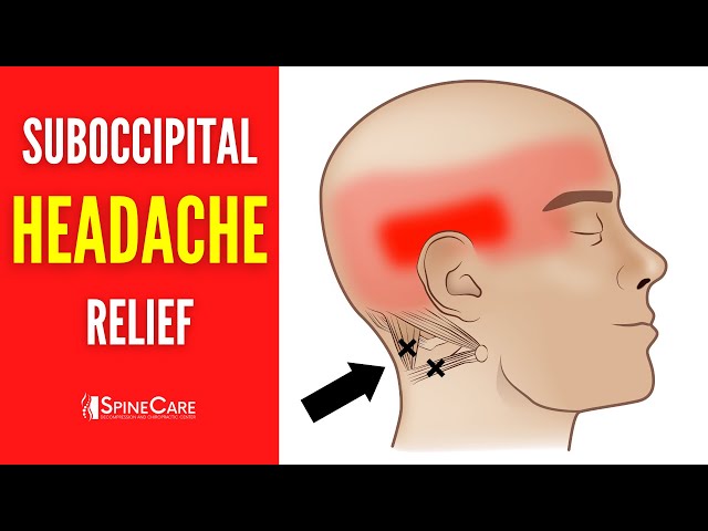 How to Release Tight Suboccipital Muscles | HEADACHE RELIEF in Seconds