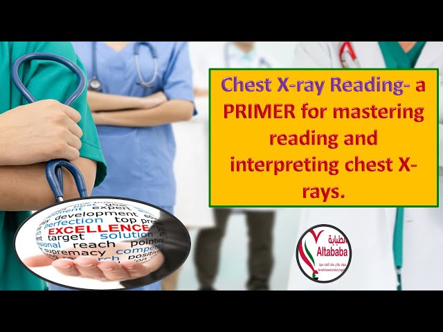 Chest X-ray Reading- a PRIMER for mastering reading and interpreting chest X-rays.