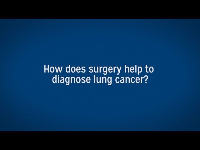 Lung Cancer Surgery for Diagnosis and Treatment