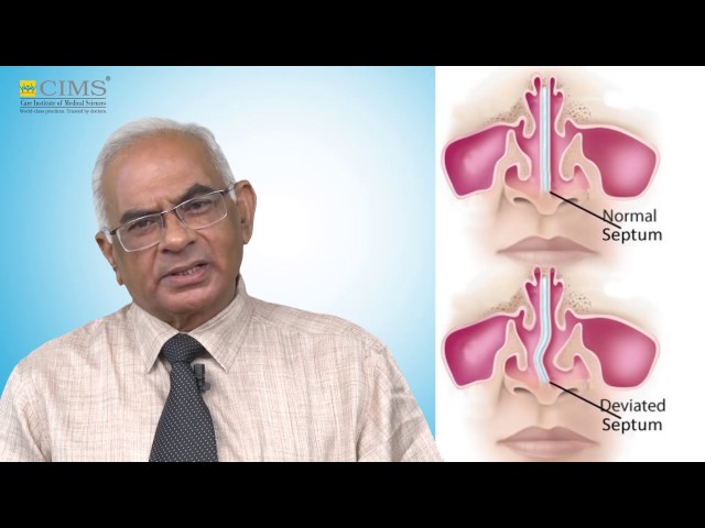 CIMS HOSPITAL - Dr. Umakant Shah - ENT Problems & Preventive Care