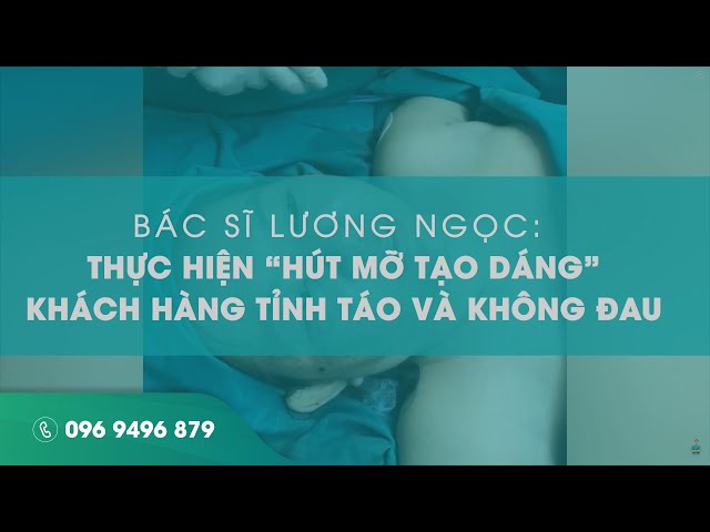 Hút mỡ đùi kết hợp cấy mỡ mông cho nữ Việt Kiều Đức đã từng hút mỡ nhưng không hiệu quả