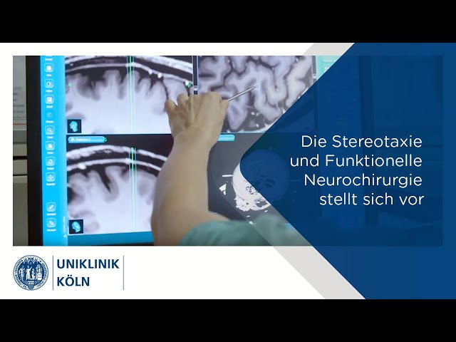 Die Stereotaxie und Funktionelle Neurochirurgie stellt sich vor | Uniklinik Köln