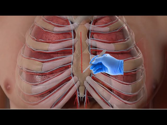 Heart Bypass Surgery (CABG): Procedure, Recovery, and Benefits| Heart Surgery 3D Animation