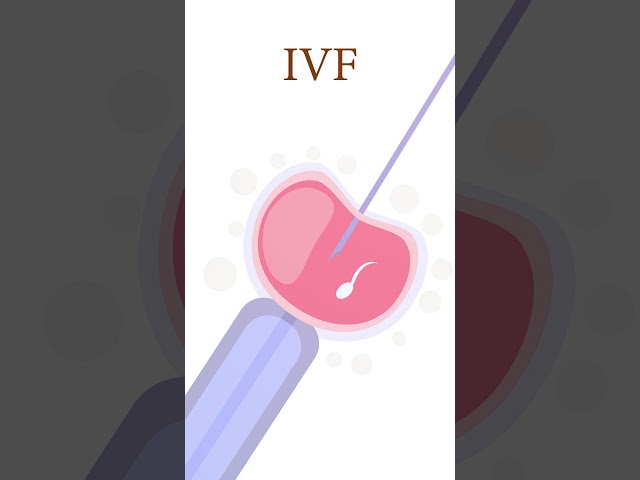 ಹೈಡ್ರೊಸಲ್ಪಿಂಕ್ಸ್ (Hydrosalpinx) ಎಂದರೇನು? ಇದಕ್ಕೆ ಚಿಕಿತ್ಸೆ ಏನು? | Dr. Nikitha Murthy | GarbhaGudi IVF